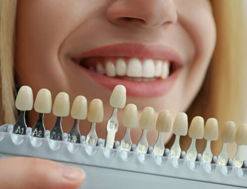 Is it Hard to Eat with Composite Veneers? Get Expert Advice