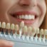 Is it hard to eat with composite veneers?