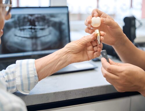 What Are The Best Dental Implant Brands Used By Clinics in Broxburn?