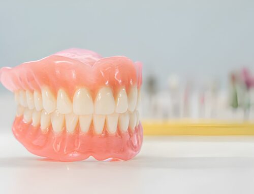 Can I Have All My Teeth Pulled and Get Dentures in the Uk?