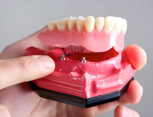 What Type of Dentures are Most Natural Looking?