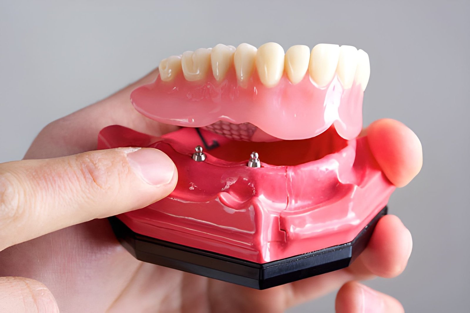 Affordable dentures Broxburn