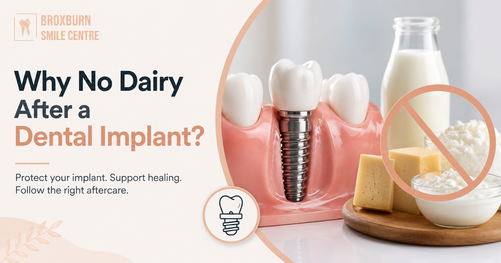 Why No Dairy After a Dental Implant?