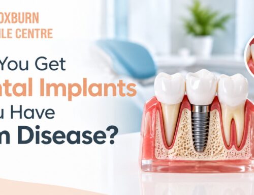 Dental Implants With Gum Disease? Broxburn Smile Centre