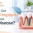 Dental Implant