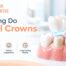 Dental Implant