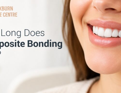 How Long Does Composite Bonding Last?