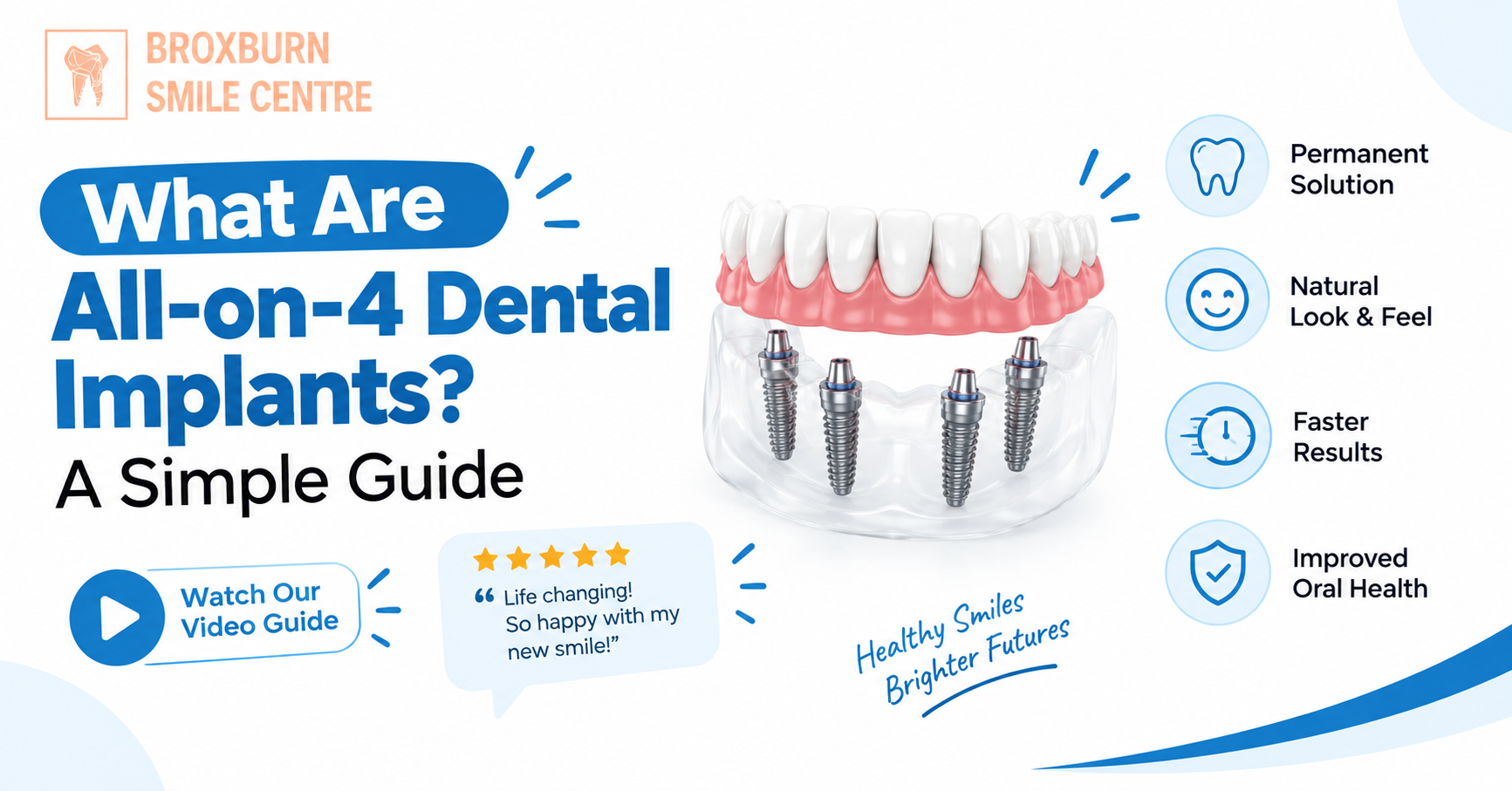 Dental Implants